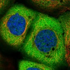 Immunofluorescent staining of human cell line A-431 shows localization to cytosol.