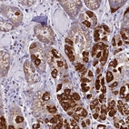 Anti-KCNG1 Antibody