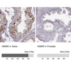 Anti-HMMR Antibody