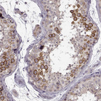 Immunohistochemical staining of human testis shows strong cytoplasmic/ membranous positivity in cells in seminiferous ducts.
