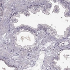 Immunohistochemical staining of human prostate shows no positivity in glandular cells as expected.