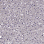 Anti-HMMR Antibody
