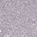 Immunohistochemical staining of human liver shows no positivity in hepatocytes as expected.