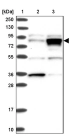 Lane 1: Marker [kDa] 250, 130, 95, 72, 55, 36, 28, 17, 10_br/_Lane 2: Human cell line RT-4_br/_Lane 3: Human cell line U-251 MG