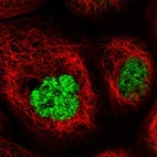Immunofluorescent staining of human cell line A-431 shows localization to nuclear speckles.