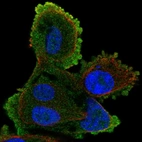 Anti-ATP8A2 Antibody