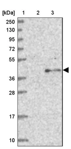 Lane 1: Marker [kDa] 250, 130, 95, 72, 55, 36, 28, 17, 10_br/_Lane 2: Human cell line RT-4_br/_Lane 3: Human cell line U-251MG sp