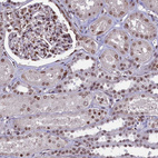 Immunohistochemical staining of human kidney shows moderate to strong nuclear positivity in cells in tubules.