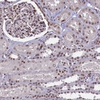 Immunohistochemical staining of human kidney shows moderate to strong nuclear positivity in cells in tubules.