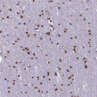 Immunohistochemical staining of human cerebral cortex shows strong nuclear positivity in glial cells.