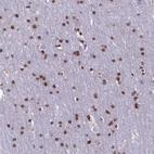Immunohistochemical staining of human cerebral cortex shows strong nuclear positivity in glial cells.