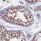 Immunohistochemical staining of human testis shows strong nuclear positivity in cells in seminiferous ducts.