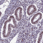 Anti-MPHOSPH8 Antibody