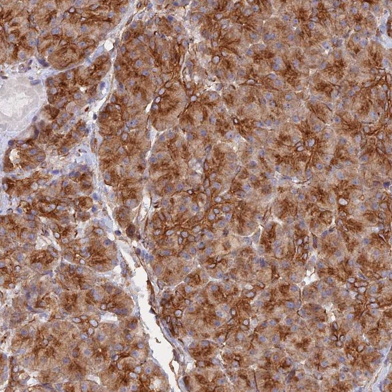 Anti-WBP11 Antibody