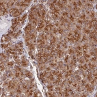 Anti-WBP11 Antibody