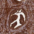 Immunohistochemical staining of human prostate shows strong granular cytoplasmic positivity in glandular cells.