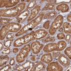 Immunohistochemical staining of human kidney shows moderate granular cytoplasmic positivity in cells in tubules.