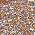 Immunohistochemical staining of human kidney shows moderate granular cytoplasmic positivity in cells in tubules.
