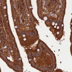 Immunohistochemical staining of human duodenum shows strong granular cytoplasmic positivity in glandular cells.
