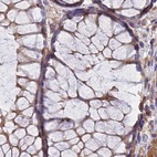 Immunohistochemical staining of human colon using Anti-DCTN2 antibody HPA040040.