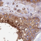 Immunohistochemical staining of human testis using Anti-DCTN2 antibody HPA040040.
