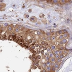 Immunohistochemical staining of human testis using Anti-DCTN2 antibody HPA040040.
