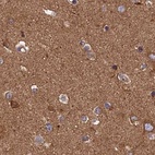 Immunohistochemical staining of human cerebral cortex using Anti-DCTN2 antibody HPA040040.