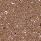 Immunohistochemical staining of human cerebral cortex using Anti-DCTN2 antibody HPA040040.