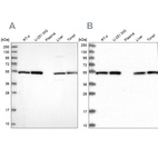 Western blot analysis using Anti-DCTN2 antibody HPA040040 (A) shows similar pattern to independent antibody HPA039715 (B).