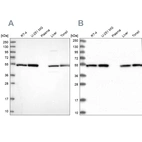 Western blot analysis using Anti-DCTN2 antibody HPA040040 (A) shows similar pattern to independent antibody HPA039715 (B).