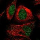 Immunofluorescent staining of human cell line U-2 OS shows localization to nucleus.