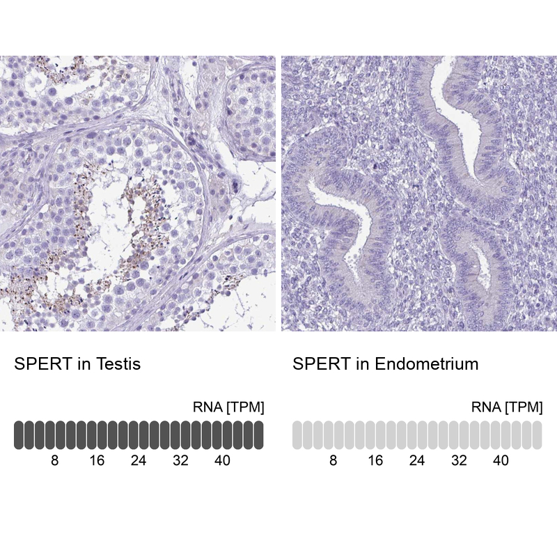 Anti-SPERT Antibody