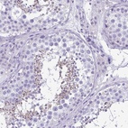 Immunohistochemical staining of human testis shows high expression.