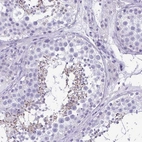 Immunohistochemical staining of human testis shows high expression.