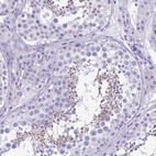 Immunohistochemical staining of human testis shows strong cytoplasmic positivity in spermatids.