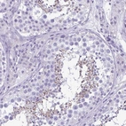 Immunohistochemical staining of human testis shows strong cytoplasmic positivity in spermatids.