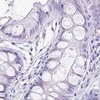 Immunohistochemical staining of human colon using Anti-SPERT antibody HPA040046.
