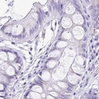 Immunohistochemical staining of human colon using Anti-SPERT antibody HPA040046.