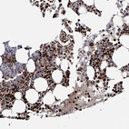 Anti-RNF6 Antibody