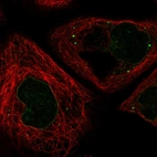 Immunofluorescent staining of human cell line A-431 shows localization to nuclear membrane & vesicles.