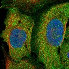 Immunofluorescent staining of human cell line U-2 OS shows localization to plasma membrane & cytosol.