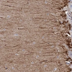 Anti-C11orf49 Antibody