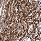 Immunohistochemical staining of human kidney shows strong cytoplasmic granular positivity in cells in tubules.