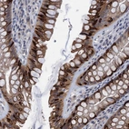 Anti-CKAP2L Antibody