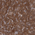 Immunohistochemical staining of human pancreas shows strong cytoplasmic positivity in exocrine glandular cells.