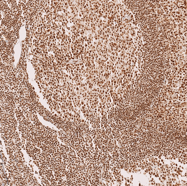Anti-METTL4 Antibody