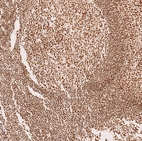 Anti-METTL4 Antibody