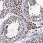 Immunohistochemical staining of human testis shows strong nuclear and cytoplasmic positivity in Leydig cells.