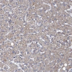 Immunohistochemical staining of human liver shows no nuclear positivity in hepatocytes as expected.