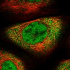 Immunofluorescent staining of human cell line A-431 shows localization to nucleoplasm & cytosol.